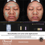 Espuma Micelar Mandélico 10%