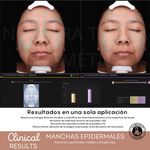 Peeling Enzimatico en Polvo Ideal para pieles sensibles y Dermapen