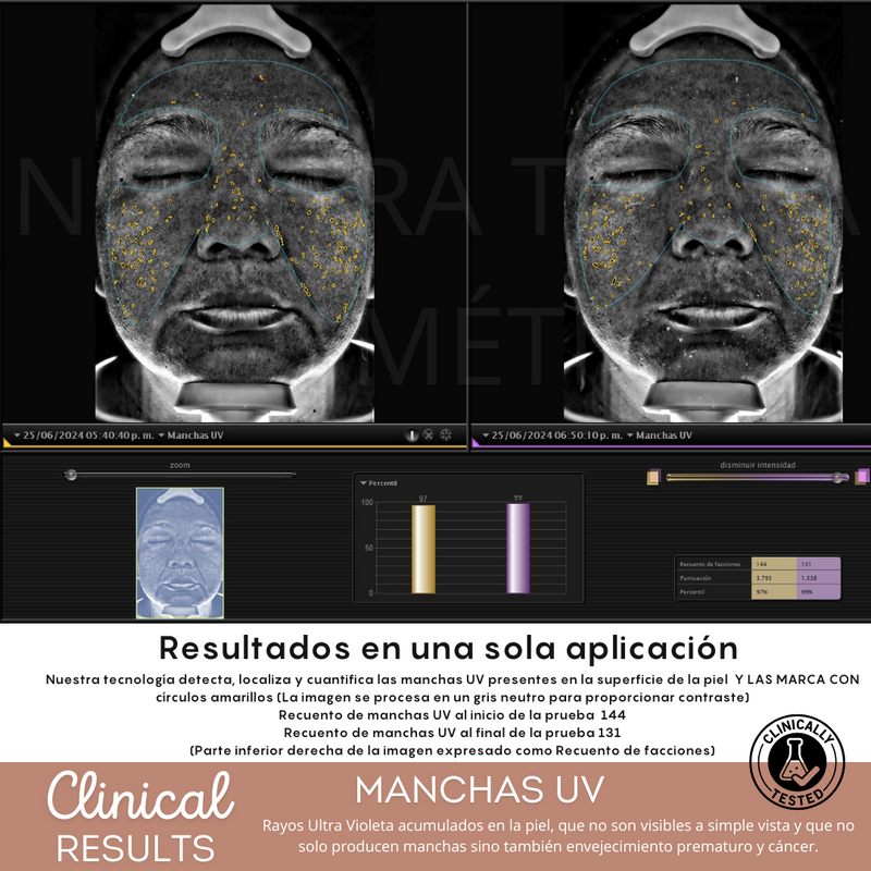 Peeling Enzimatico en Polvo Ideal para pieles sensibles y Dermapen