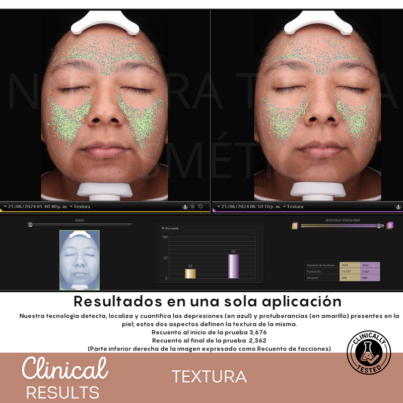 Peeling Enzimatico en Polvo Ideal para pieles sensibles y Dermapen