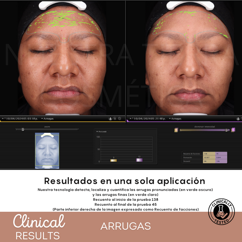 Espuma Micelar Mandélico 10%