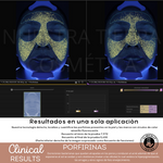 Peeling Enzimatico en Polvo Ideal para pieles sensibles y Dermapen