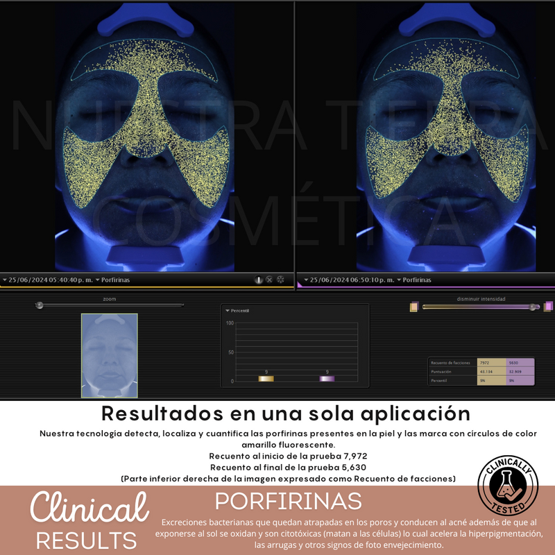 Peeling Enzimatico en Polvo Ideal para pieles sensibles y Dermapen