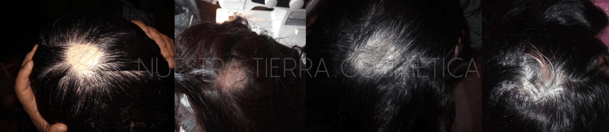 Capinox Locion para crecimiento de barba, bigote y cabello - Nuestra Tierra Cosmética Ancestral