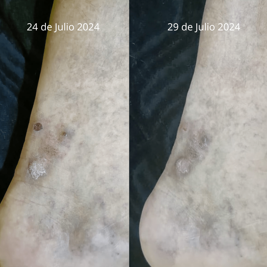 Crema Ozonizada Sales del Mar Muerto Cicatrizante - Nuestra Tierra Cosmética Ancestral