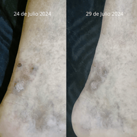 Crema Ozonizada Sales del Mar Muerto Cicatrizante - Nuestra Tierra Cosmética Ancestral