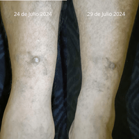 Crema Ozonizada Sales del Mar Muerto Cicatrizante - Nuestra Tierra Cosmética Ancestral