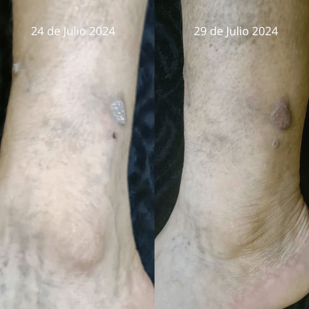 Crema Ozonizada Sales del Mar Muerto Cicatrizante - Nuestra Tierra Cosmética Ancestral
