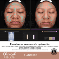 Espuma Micelar Mandélico 10% - Nuestra Tierra Cosmética Ancestral