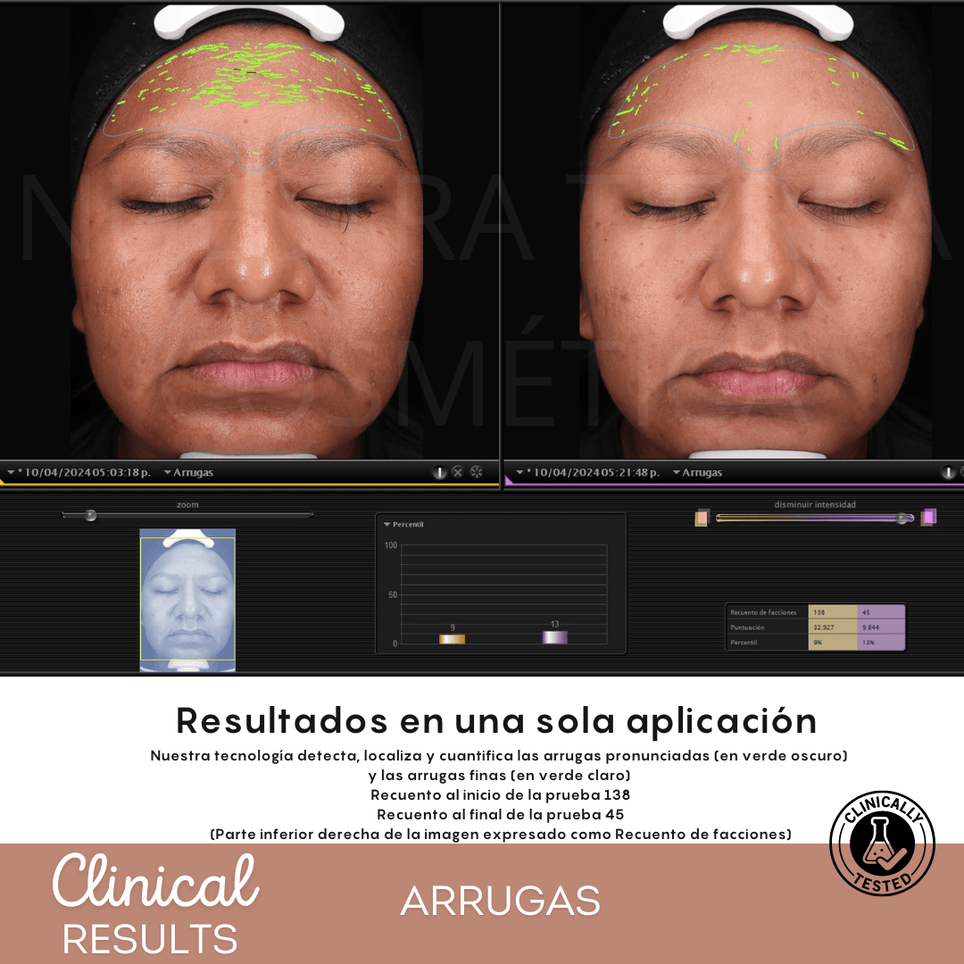 Espuma Micelar Mandélico 10% - Nuestra Tierra Cosmética Ancestral