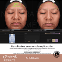 Espuma Micelar Mandélico 10% - Nuestra Tierra Cosmética Ancestral