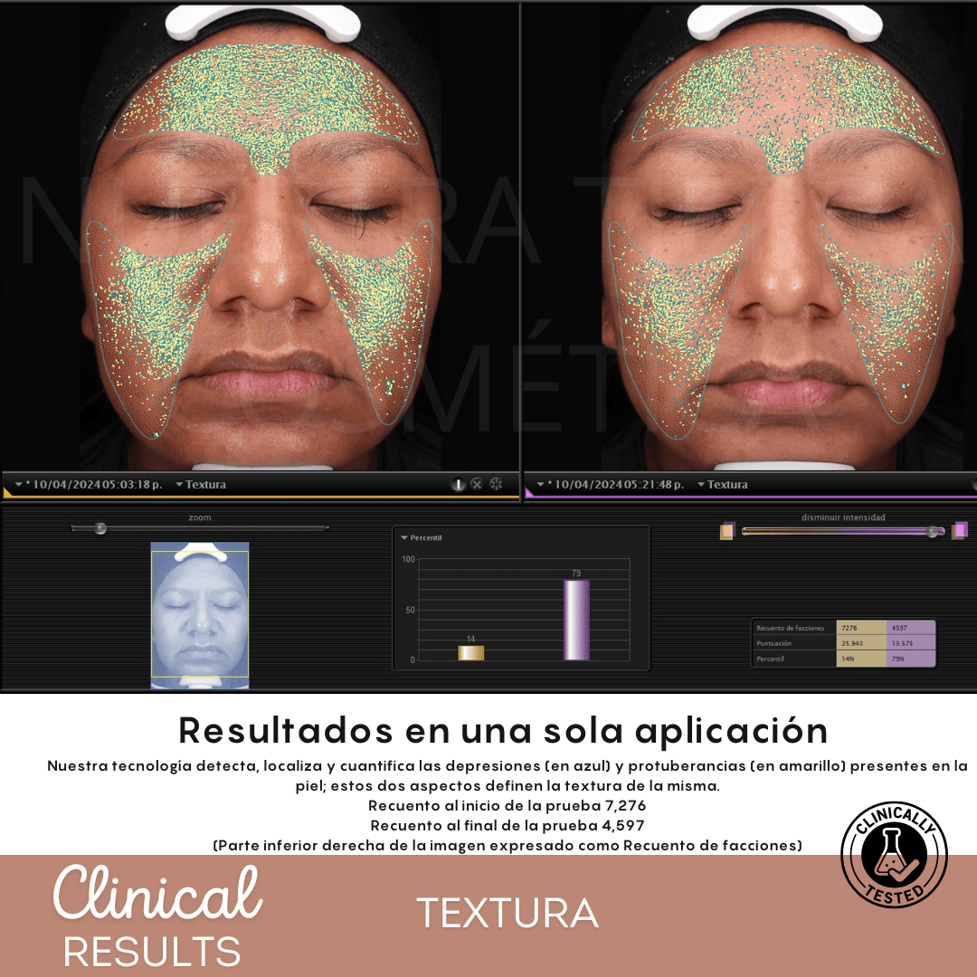 Espuma Micelar Mandélico 10% - Nuestra Tierra Cosmética Ancestral
