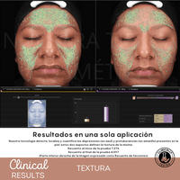 Espuma Micelar Mandélico 10% - Nuestra Tierra Cosmética Ancestral