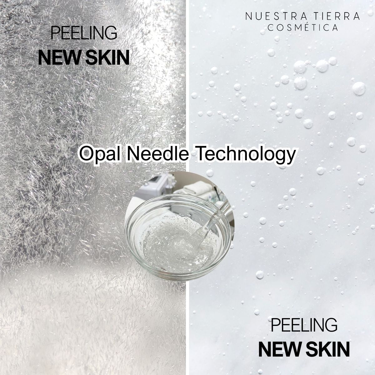 Kit Peeling New Skin Nueva Piel en 7 días sin ácidos Opal Needle Technology - Nuestra Tierra Cosmética Ancestral