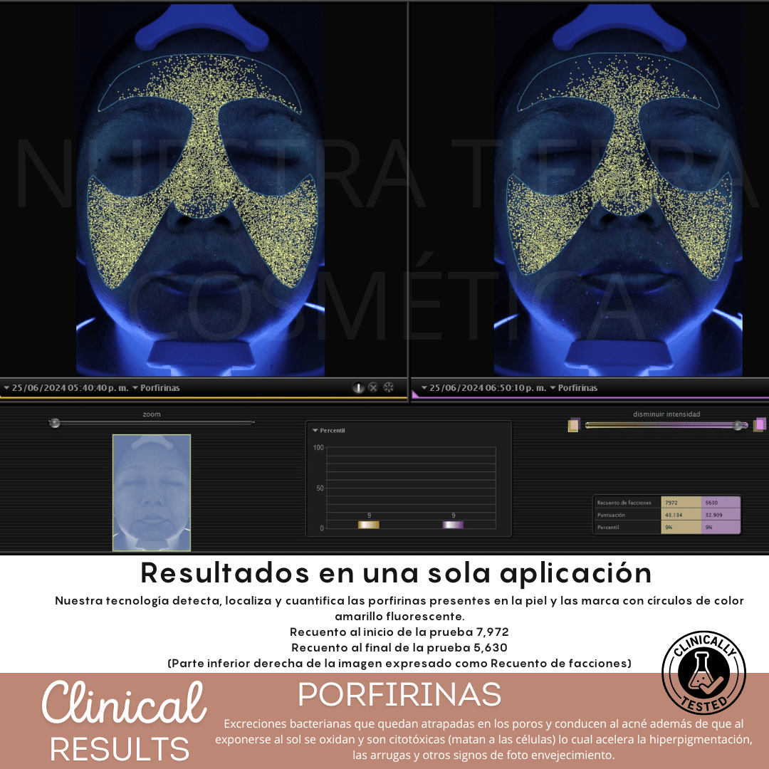 Peeling Enzimatico en Polvo Ideal para pieles sensibles y Dermapen - Nuestra Tierra Cosmética Ancestral