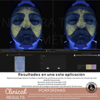 Peeling Enzimatico en Polvo Ideal para pieles sensibles y Dermapen - Nuestra Tierra Cosmética Ancestral