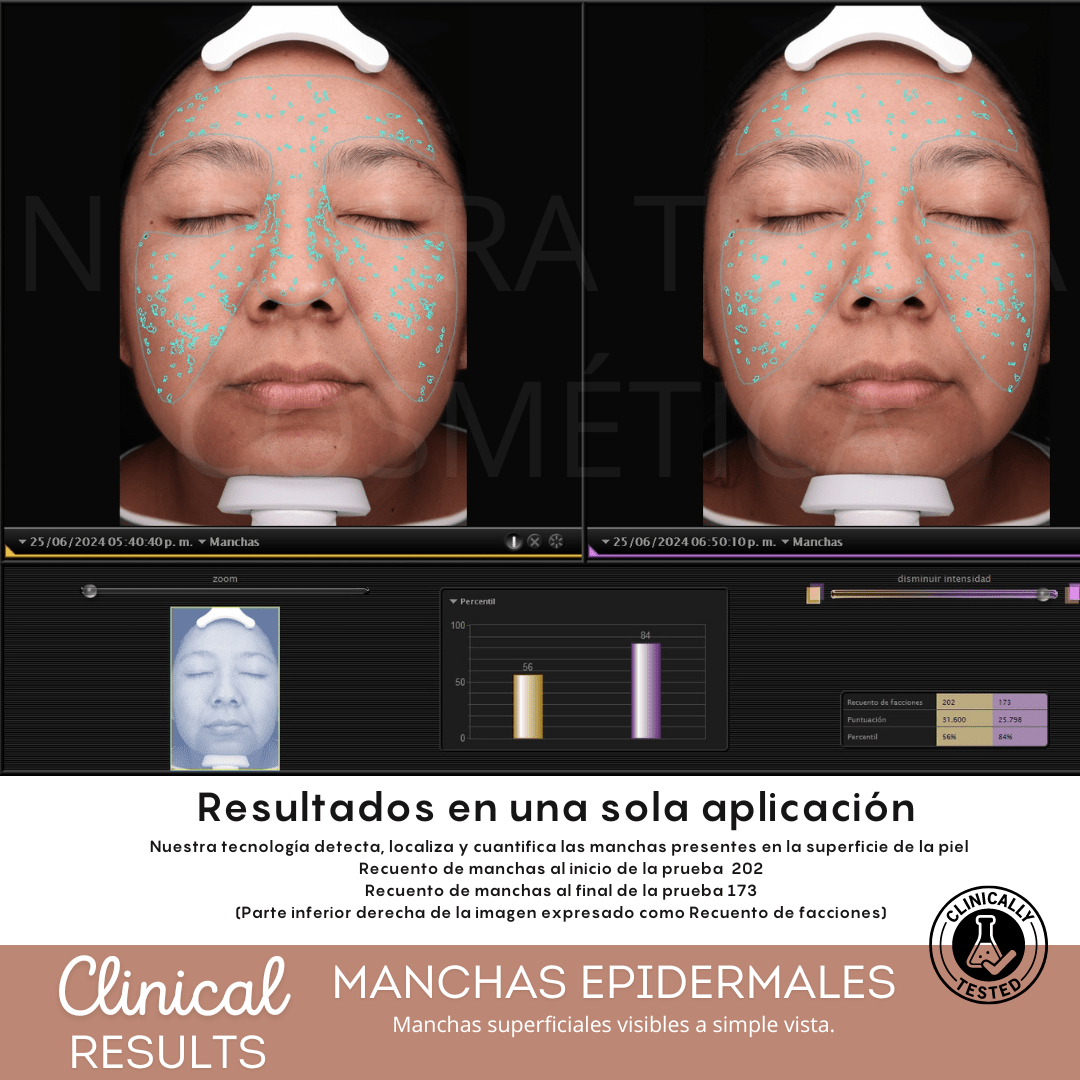Peeling Enzimatico en Polvo Ideal para pieles sensibles y Dermapen - Nuestra Tierra Cosmética Ancestral