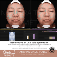 Peeling Enzimatico en Polvo Ideal para pieles sensibles y Dermapen - Nuestra Tierra Cosmética Ancestral