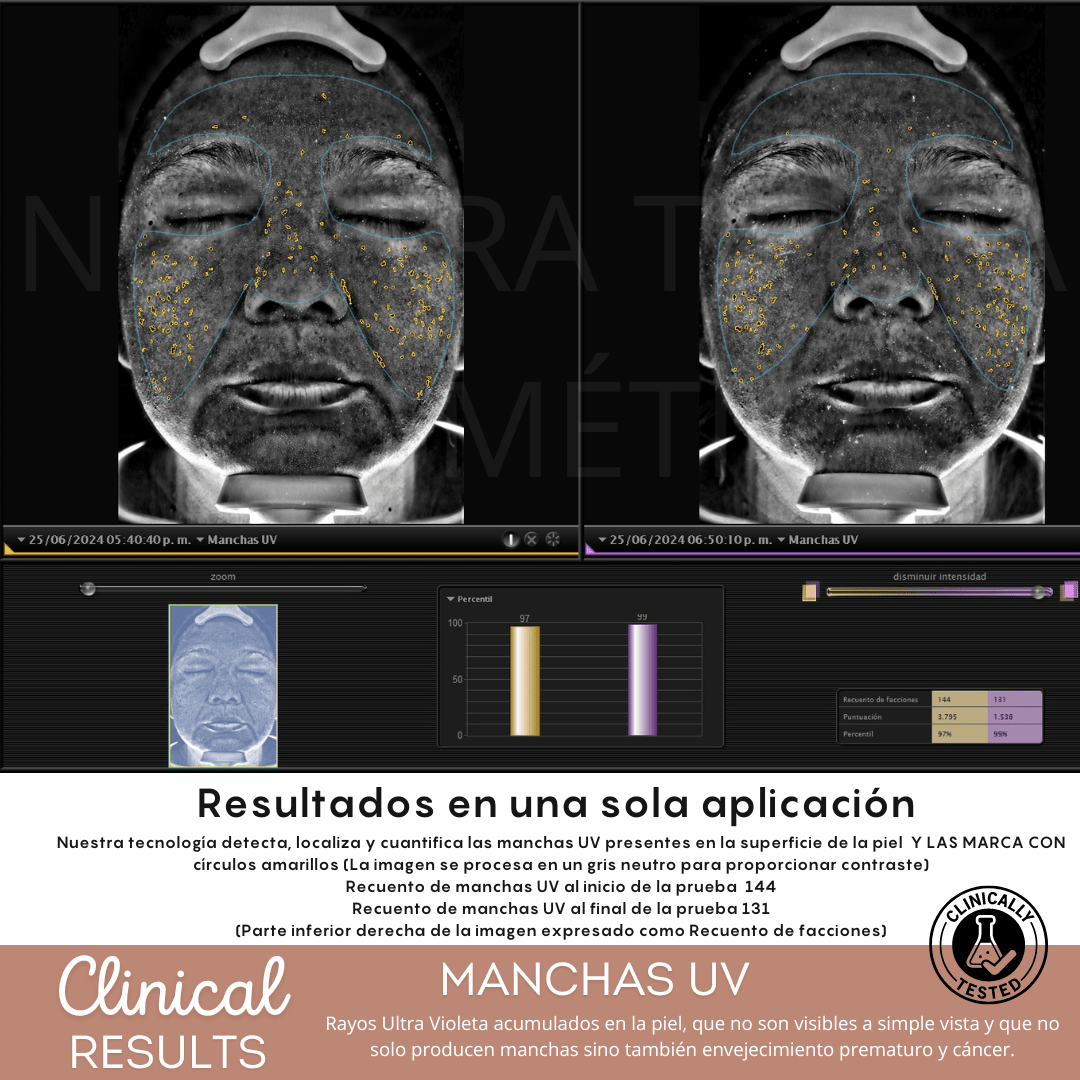 Peeling Enzimatico en Polvo Ideal para pieles sensibles y Dermapen - Nuestra Tierra Cosmética Ancestral