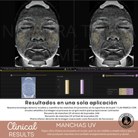 Peeling Enzimatico en Polvo Ideal para pieles sensibles y Dermapen - Nuestra Tierra Cosmética Ancestral