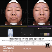 Peeling Enzimatico en Polvo Ideal para pieles sensibles y Dermapen - Nuestra Tierra Cosmética Ancestral