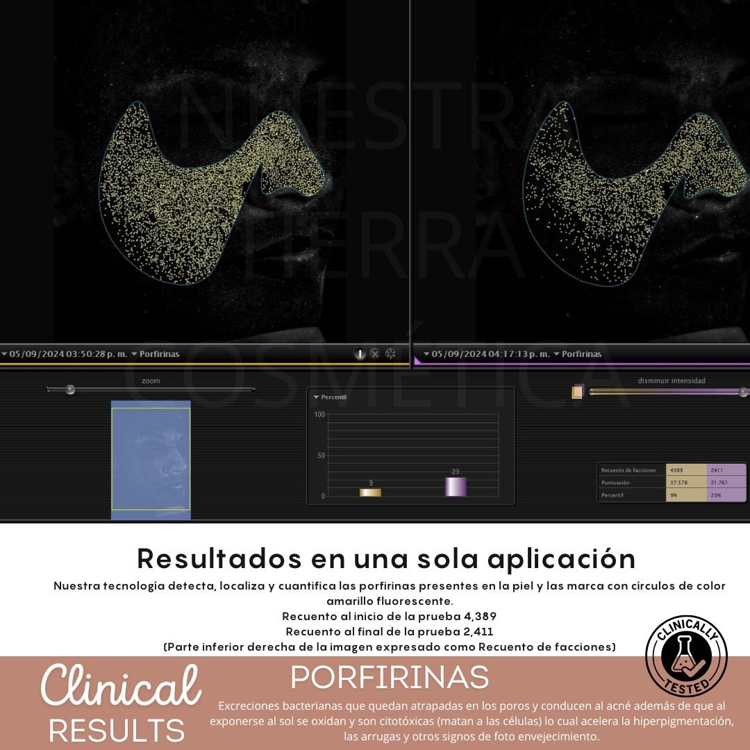 Shampoo Sales Del Mar Muerto - Nuestra Tierra Cosmética Ancestral