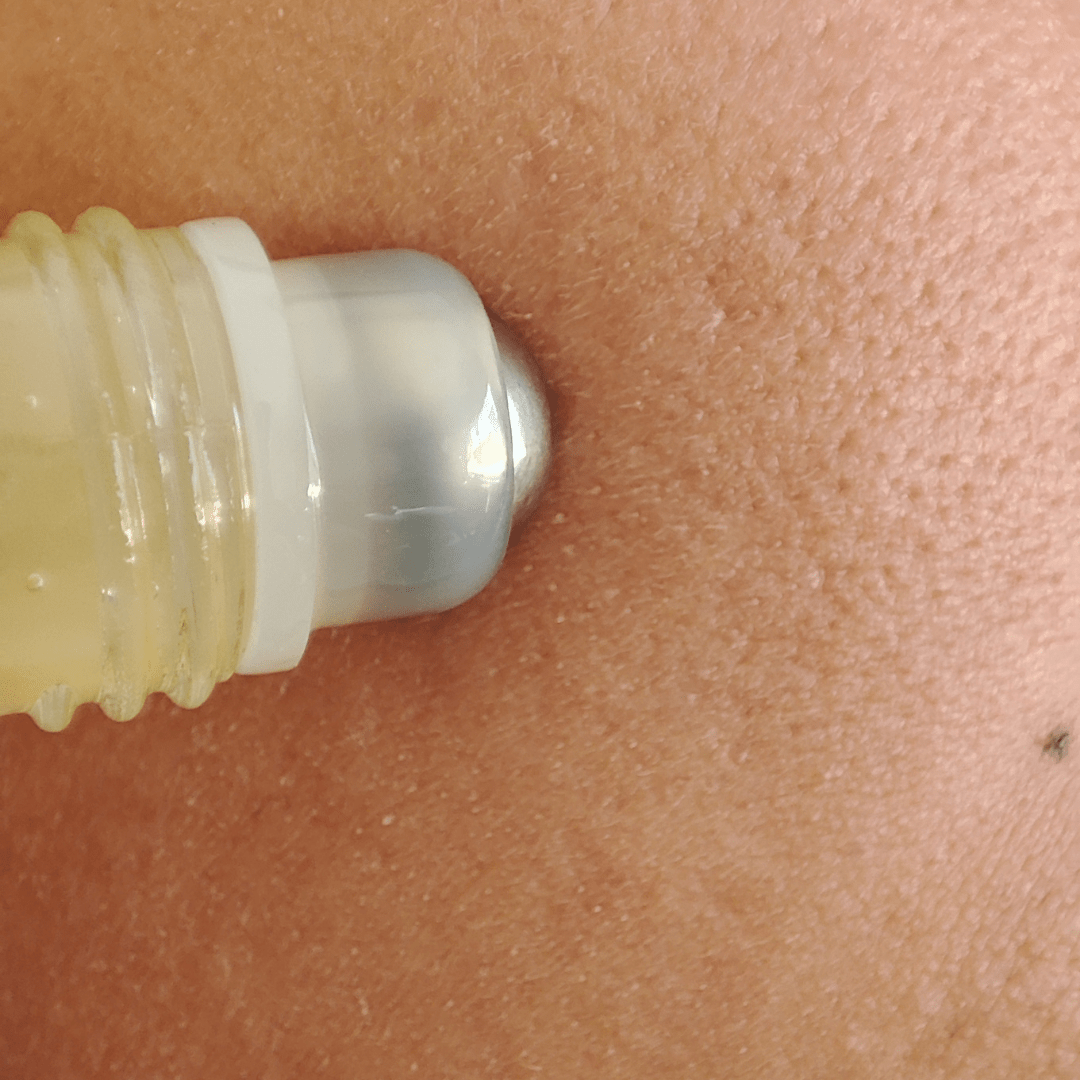 Acne Clear Roll On Secador de Barros - Nuestra Tierra Cosmética Ancestral