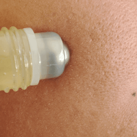 Acne Clear Roll On Secador de Barros - Nuestra Tierra Cosmética Ancestral